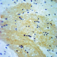 19 - Anti-A-RAF (Phospho-Y302) Antibody AP51636
