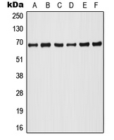 1 - Anti-A-RAF (Phospho-Y302) Antibody AP51636