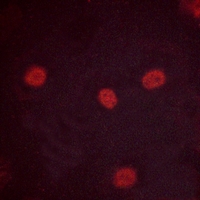 3 - Anti-MYBL2 (Phospho-S577) Antibody AP51638