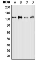 1 - Anti-MYBL2 (Phospho-S577) Antibody AP51638