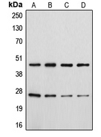 1 - Anti-CD28 (Phospho-Y218) Antibody AP51639