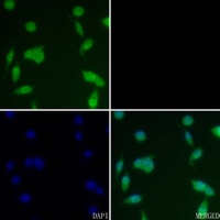3 - Anti-CK2 beta (Phospho-S209) Antibody AP51640