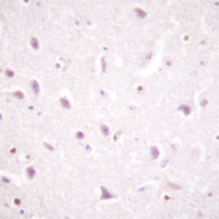 19 - Anti-CK2 beta (Phospho-S209) Antibody AP51640