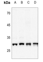 1 - Anti-CK2 beta (Phospho-S209) Antibody AP51640