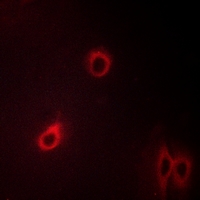 3 - Anti-CD184 (Phospho-S339) Antibody AP51641