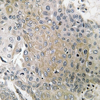 19 - Anti-CD184 (Phospho-S339) Antibody AP51641