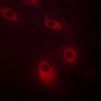 3 - Anti-Cytokeratin 18 (Phospho-S52) Antibody AP51642