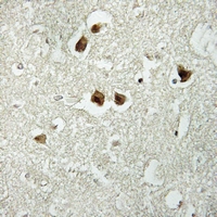 19 - Anti-Cytokeratin 18 (Phospho-S52) Antibody AP51642