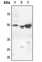 1 - Anti-Cytokeratin 18 (Phospho-S52) Antibody AP51642