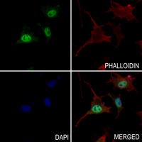 3 - Anti-Alpha-crystallin B (Phospho-S19) Antibody AP51643