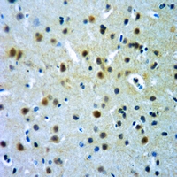 19 - Anti-Alpha-crystallin B (Phospho-S19) Antibody AP51643