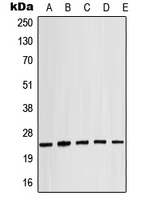 1 - Anti-Alpha-crystallin B (Phospho-S19) Antibody AP51643