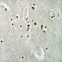 19 - Anti-MCM4 (Phospho-S54) Antibody AP51644