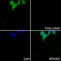 3 - Anti-GLUR4 (Phospho-S862) Antibody AP51646