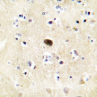 19 - Anti-GLUR4 (Phospho-S862) Antibody AP51646