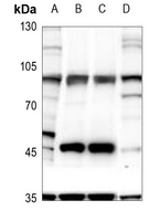 1 - Anti-GLUR4 (Phospho-S862) Antibody AP51646