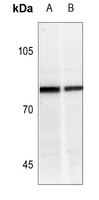 1 - Anti-IFNGR1 (Phospho-Y457) Antibody AP51647