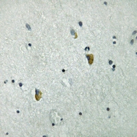 19 - Anti-GRB10 (Phospho-Y67) Antibody AP51648