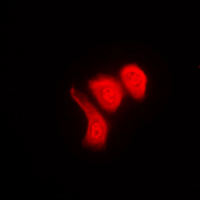3 - Anti-hnRNP K (Phospho-S284) Antibody AP51649
