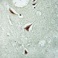 19 - Anti-hnRNP K (Phospho-S284) Antibody AP51649