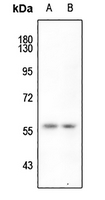 1 - Anti-hnRNP K (Phospho-S284) Antibody AP51649