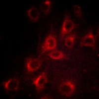 3 - Anti-Kv1.3 (Phospho-Y187) Antibody AP51650