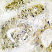 19 - Anti-FANCA (Phospho-S1149) Antibody AP51652
