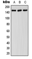 1 - Anti-FANCA (Phospho-S1149) Antibody AP51652