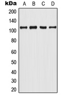 1 - Anti-Androgen Receptor (Phospho-Y363) Antibody AP51656