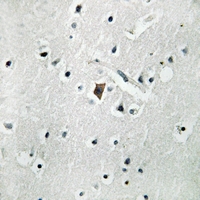 19 - Anti-Phospholipase D2 (Phospho-Y169) Antibody AP51658