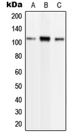1 - Anti-Phospholipase D2 (Phospho-Y169) Antibody AP51658