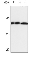 1 - Anti-ANP32C Antibody AP51661