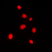 3 - Anti-AKAP8 Antibody [KO/KD Validated] AP51662