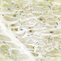 19 - Anti-AKAP8 Antibody [KO/KD Validated] AP51662
