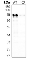 0 - Anti-AKAP8 Antibody [KO/KD Validated] AP51662