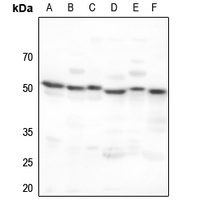 1 - Anti-ADA2A Antibody AP51664