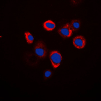 3 - Anti-Renin Receptor Antibody AP51665