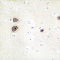 19 - Anti-Renin Receptor Antibody AP51665