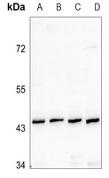 1 - Anti-Renin Receptor Antibody AP51665