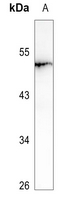 1 - Anti-LRAT Antibody AP51668