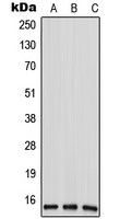 1 - Anti-ANP32D Antibody AP51669