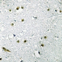 19 - Anti-TFE3 Antibody AP51672