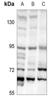 1 - Anti-TFE3 Antibody AP51672