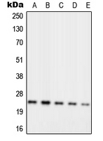 1 - Anti-RPL10 Antibody AP51674