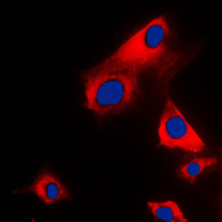 3 - Anti-Glycerol Kinase 1 Antibody AP51676