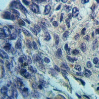 19 - Anti-Glycerol Kinase 1 Antibody AP51676