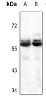 1 - Anti-Glycerol Kinase 1 Antibody AP51676