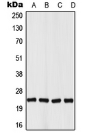 1 - Anti-Von Hippel Lindau Antibody AP51677