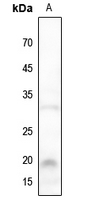1 - Anti-NBL1 Antibody AP51678