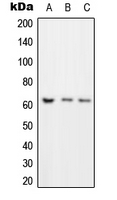 1 - Anti-ROR gamma Antibody AP51679